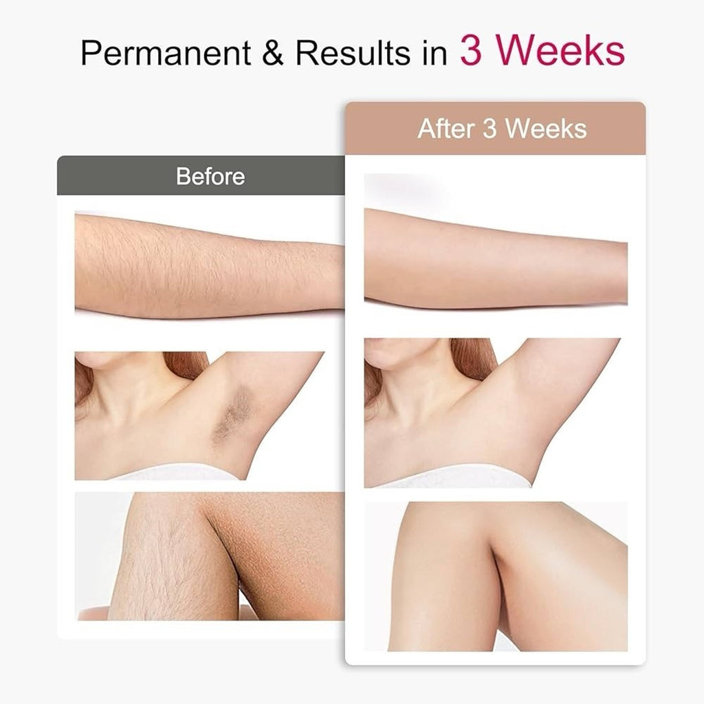 IPL Sapphire Laser Hair Removal for Women & Men with Ice Cooling, Painless Hair