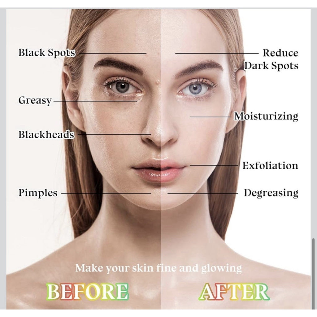 10PCS Hydrating Face Masks,Moisturizing Facial Masks for Women