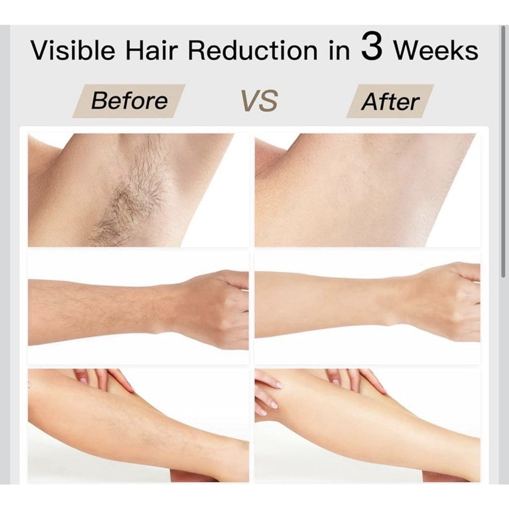 BoSidin Pioneer-Pro Permanent Hair Removal Device
