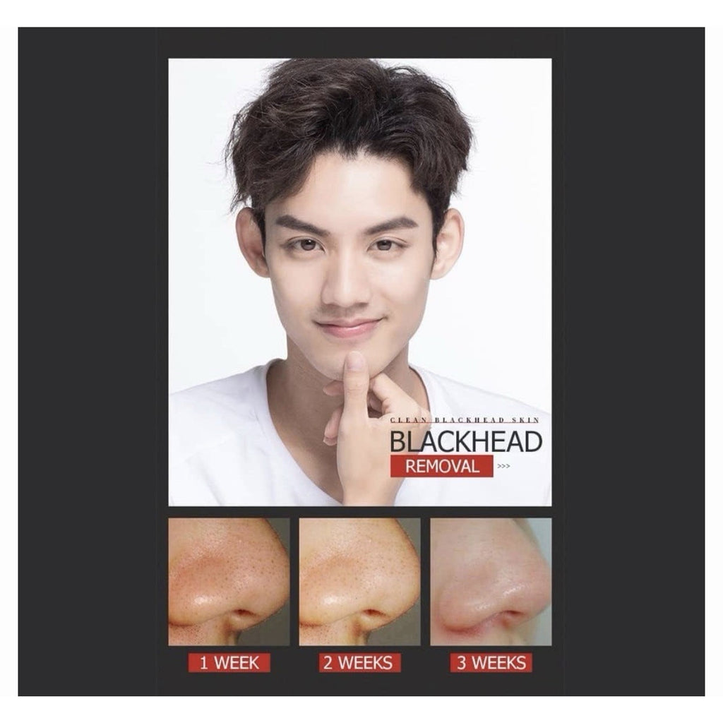 VENZEN Men's Cool Blackhead Removal Essence Nose Mask Pores Cleansing 3pcs Set